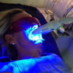 Philips Zoom Laser Teeth Whitening