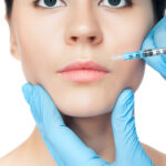 Dermal Fillers