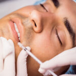 Dermal Fillers for Men