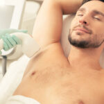 Hyperhidrosis for Men