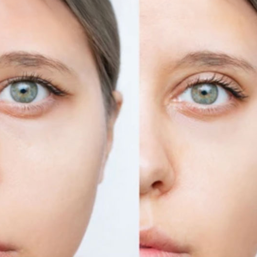 Angel-wellness-retreat-Lumi-Eyes-700x500 Lumi Eyes - Image 1