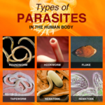 Parasite Zapping