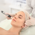 Microneedling Facial Treatments