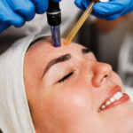 Luxury Microneedling Facial