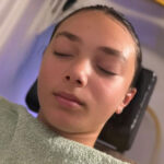 A teenage girl before getting a facial.